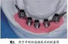 人鱼和人paro车